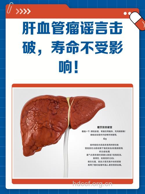 肝血管瘤治疗有什么误区