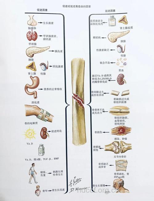 影响骨折愈合因素和标准有哪些?