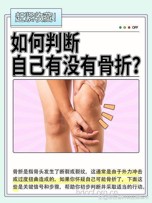骨折也能听出来?从5方面判断