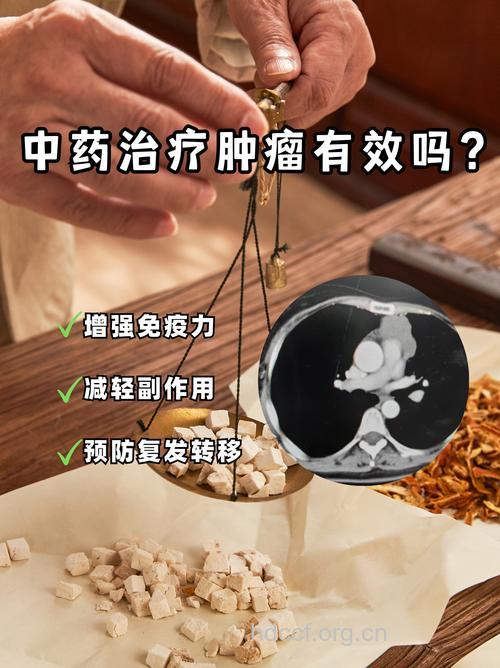 中医”抑扶平衡疗法“治肿瘤效果喜人