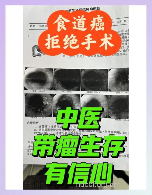 中药治疗食管癌三大效果