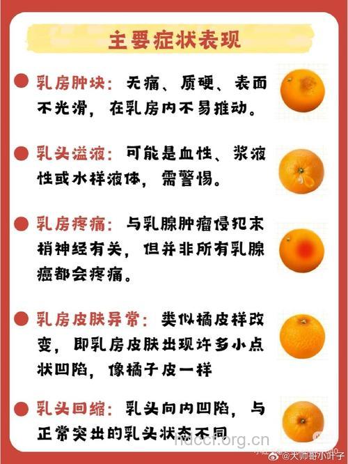 对乳腺癌认识的9个误区