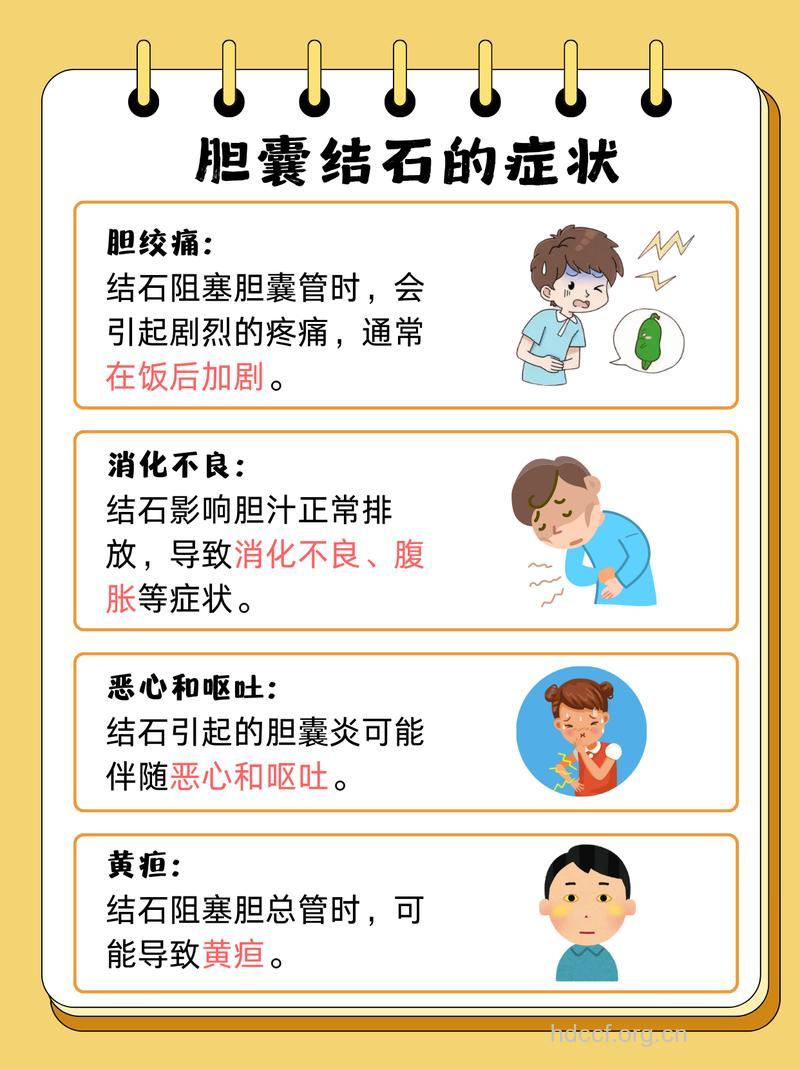 胆结石治疗有哪些误区