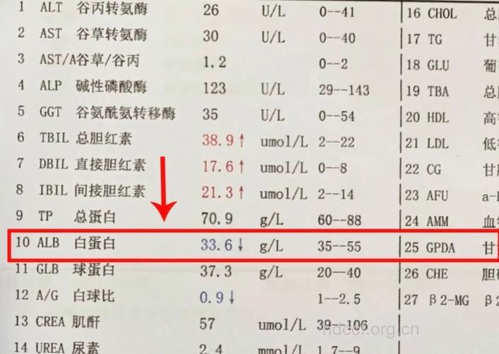 肝脏病患者需限脂限蛋白