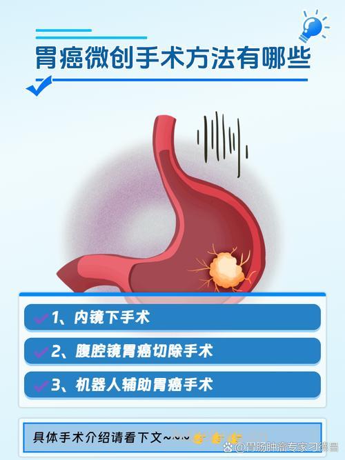 微创治疗肿瘤有哪些优势