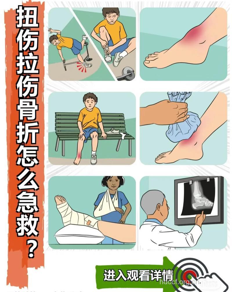 骨折急救的正确处理方法