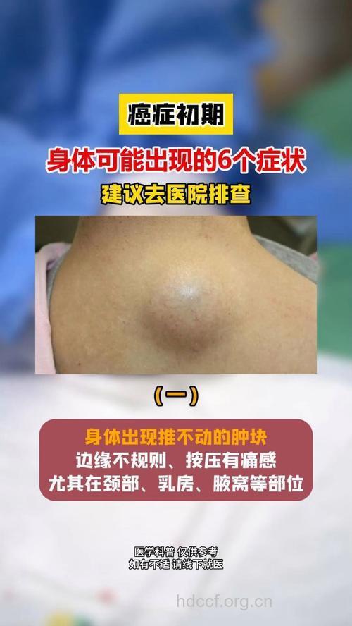 关于肿瘤初期身体有哪些异常