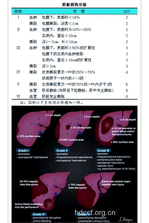 肝癌破裂出血有哪些诊治方法