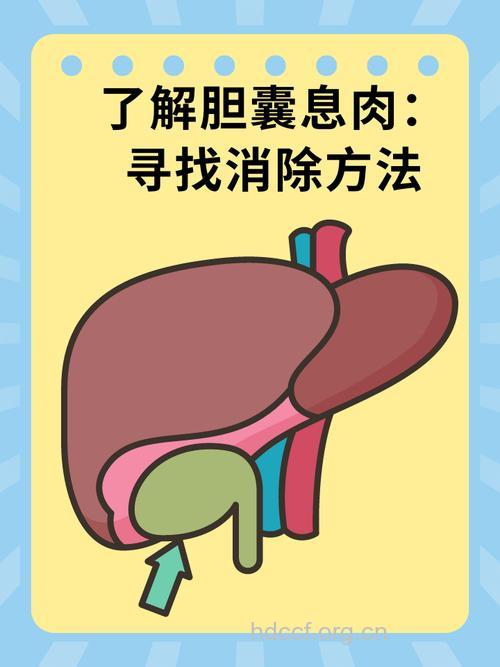 怎么诊治胆囊息肉方法