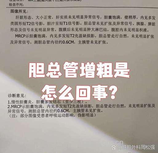 为什么会导致胆管增粗