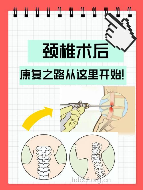 颈椎病病人手术后的康复的疗法