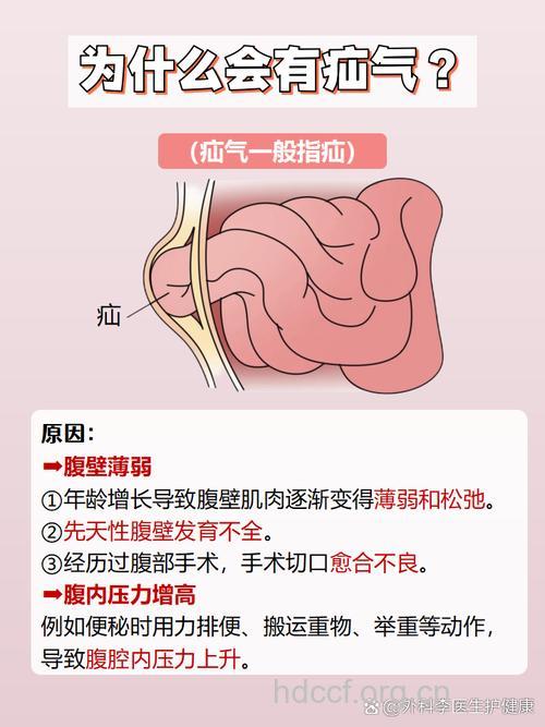 为什么会发生腹外疝