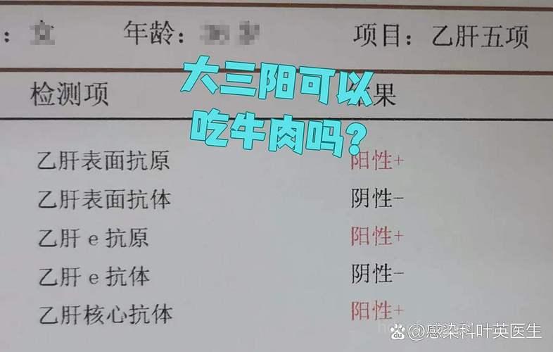 乙肝患者可以吃牛肉吗