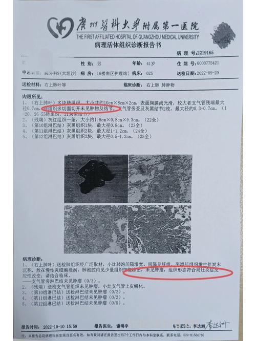 软组织肿瘤2/3被误诊误治