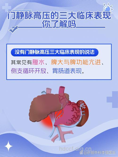 专家解析门静脉高压症