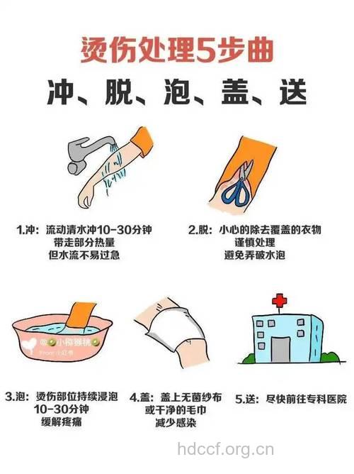 烧伤后的7种处理方法 冷水浸泡
