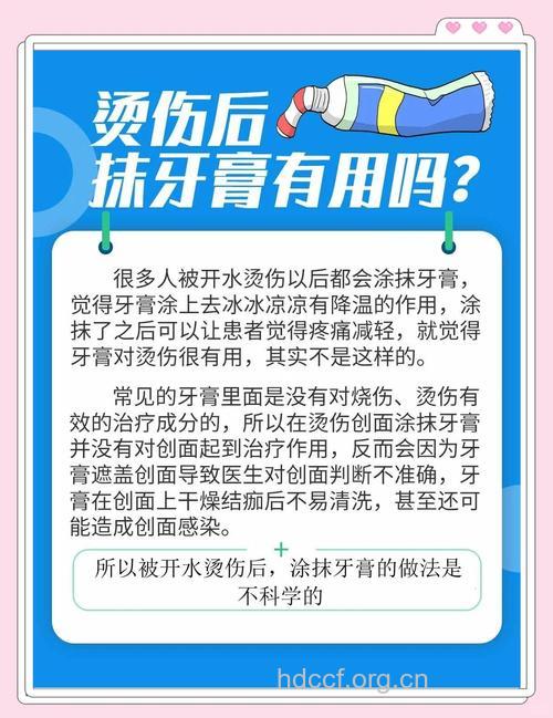 被烫伤后用牙膏真的好吗