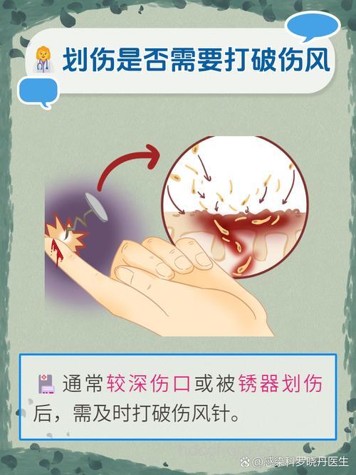 伤口无论多小 都要警惕破伤风