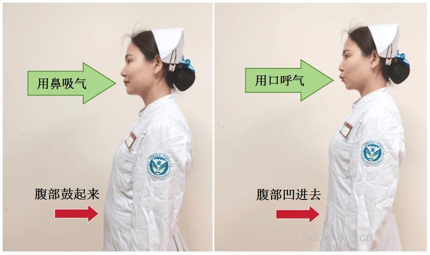 肺癌术后要做什么康复运动