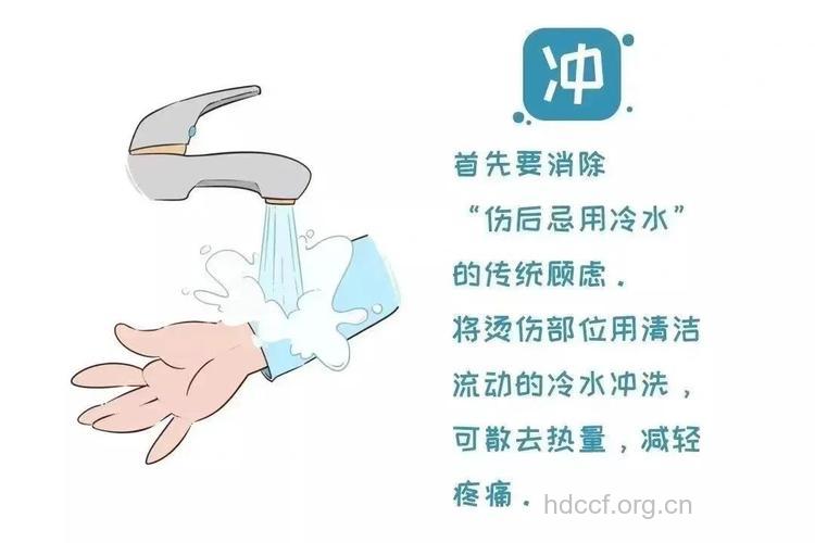 热烧伤如何进行紧急处理