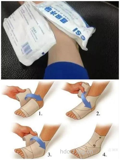 脚扭伤后的护理方法
