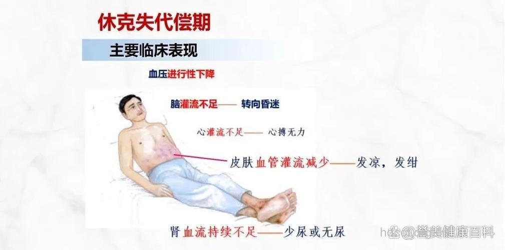 关于休克早期有什么症状