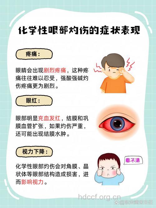 眼酸硷化学伤有什么症状