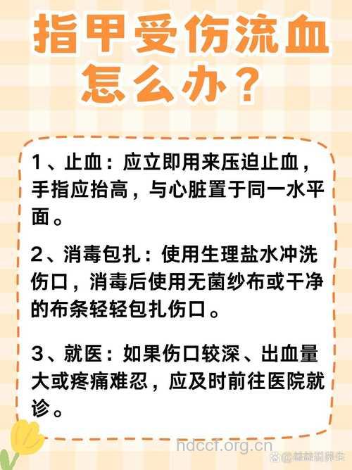 指甲出血应该怎么急救