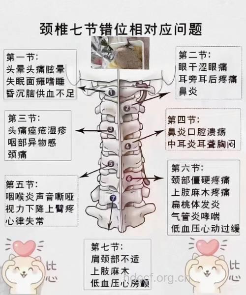 专家称按摩可能对颈椎患者有害