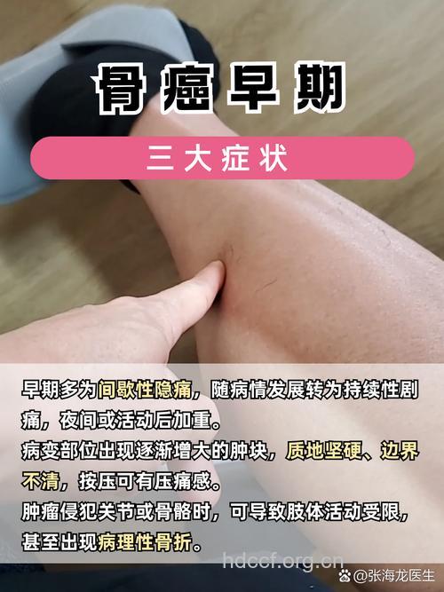 骨癌早期有哪些症状
