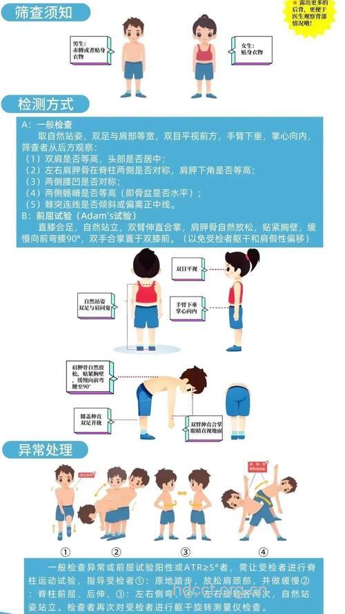 脊椎是否健康的15个检查法