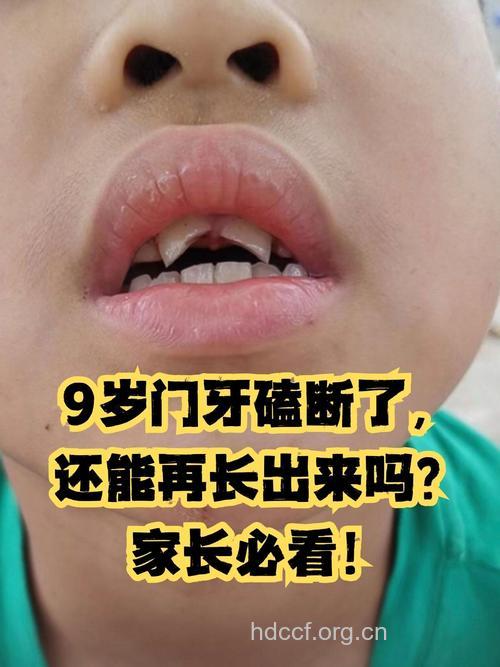 暑假是儿童牙外伤的高发期