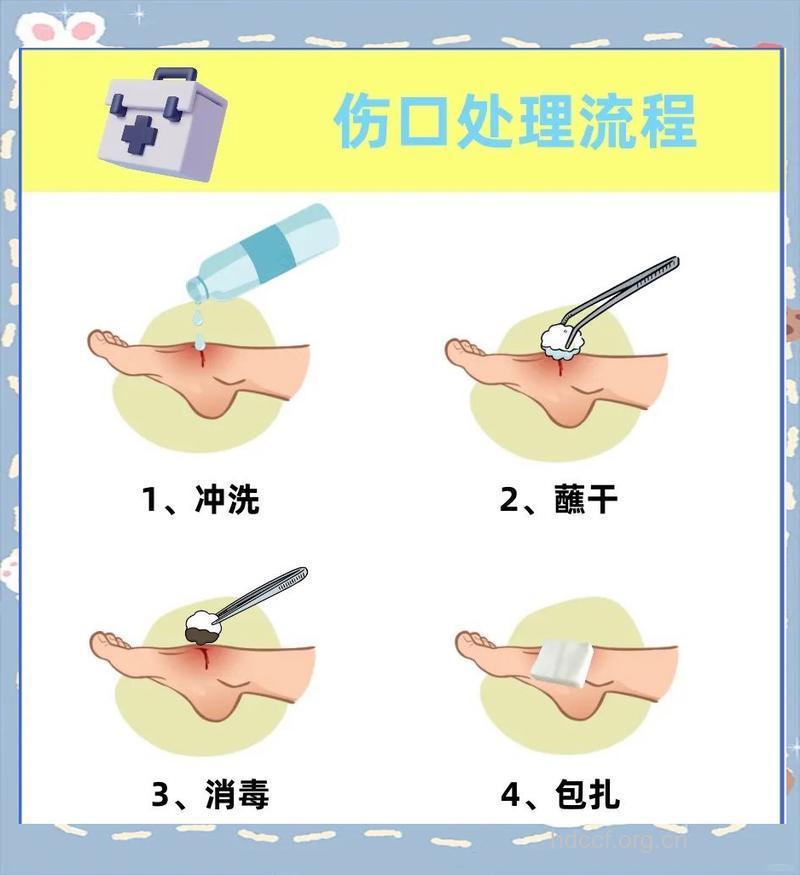 关于外伤怎么清洁伤口