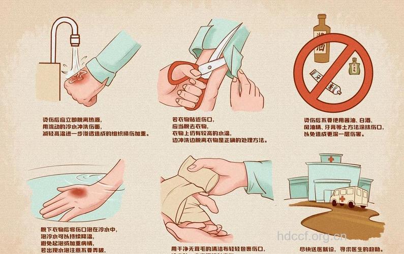 烧伤后什么是液体复苏法