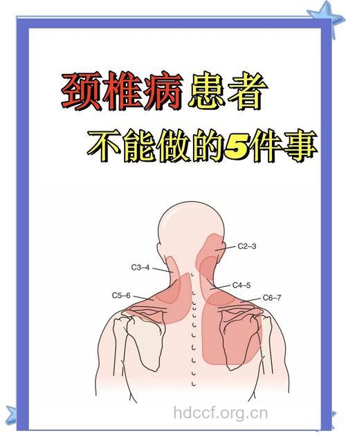 颈椎病的6大杀手 你中招了吗