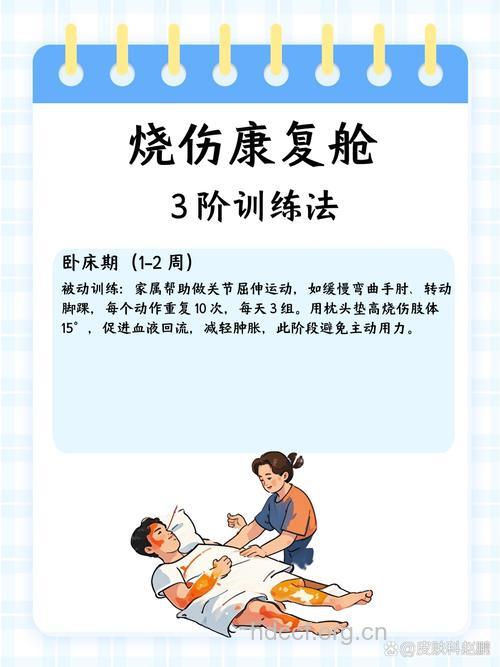 烧伤后怎么进行康复训练