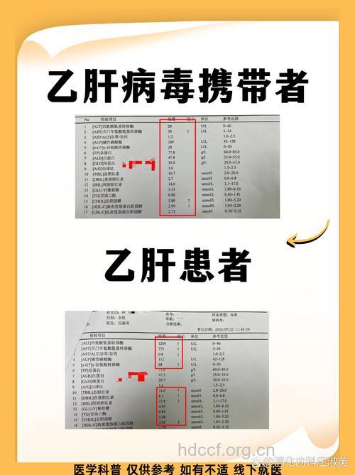 乙肝患者与乙肝病毒携带者的区别