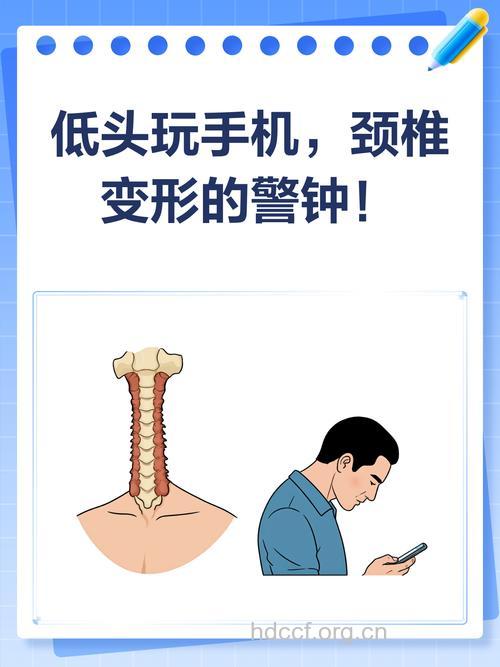 “低头族”小心患颈椎病