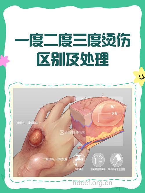 电烧伤有哪些病理原因