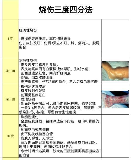 对于电烧伤有哪些分类方法