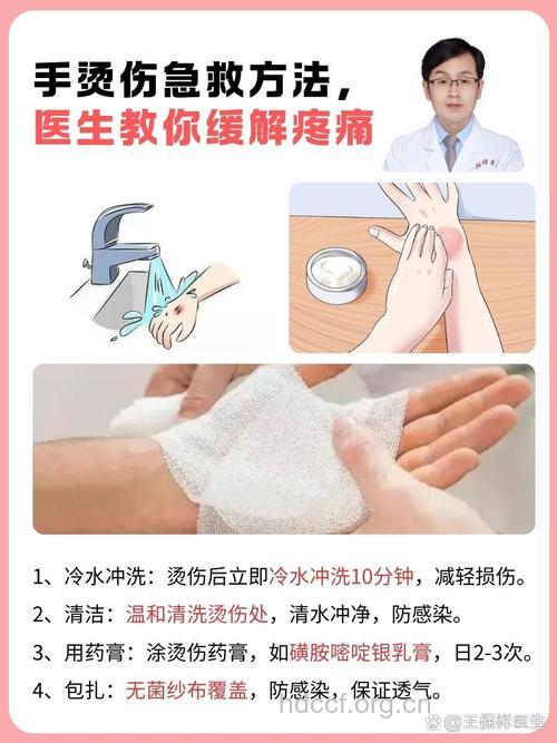 对于手电烧伤怎么治疗