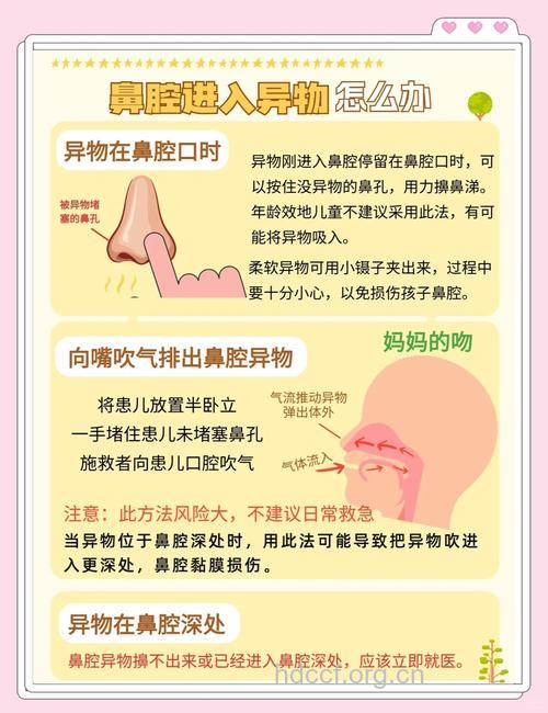 儿童异物入鼻有哪些处理方法