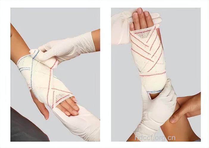 外伤包扎有哪些注意事项