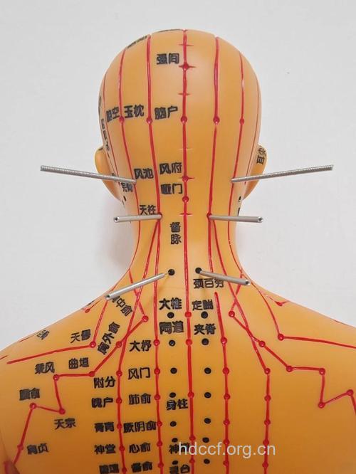 中医如何针灸治疗颈椎病