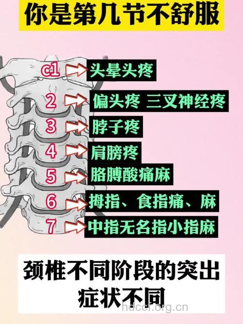 颈椎病的早期主要有哪些症状