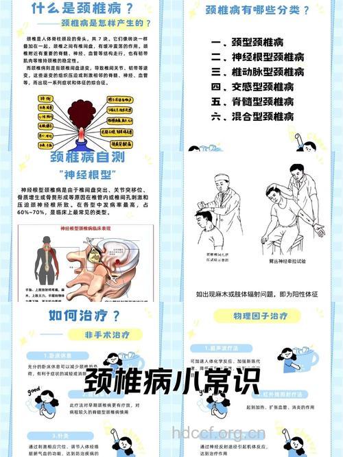 关于颈椎综合症有什么常识