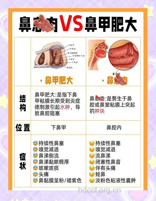 鼻息肉需与5种疾病相鉴别