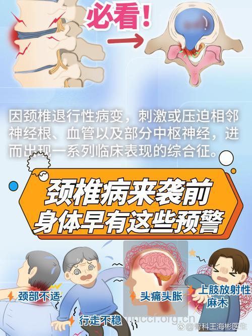 颈椎病为什么呈年轻化趋势发展