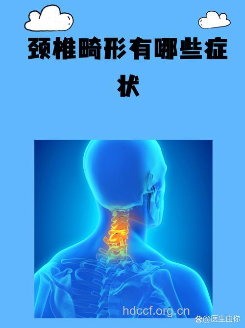 先天性畸形是颈椎病的成因