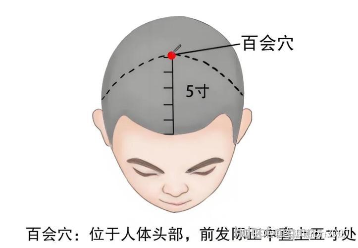 揉按百会穴 可治慢性鼻炎